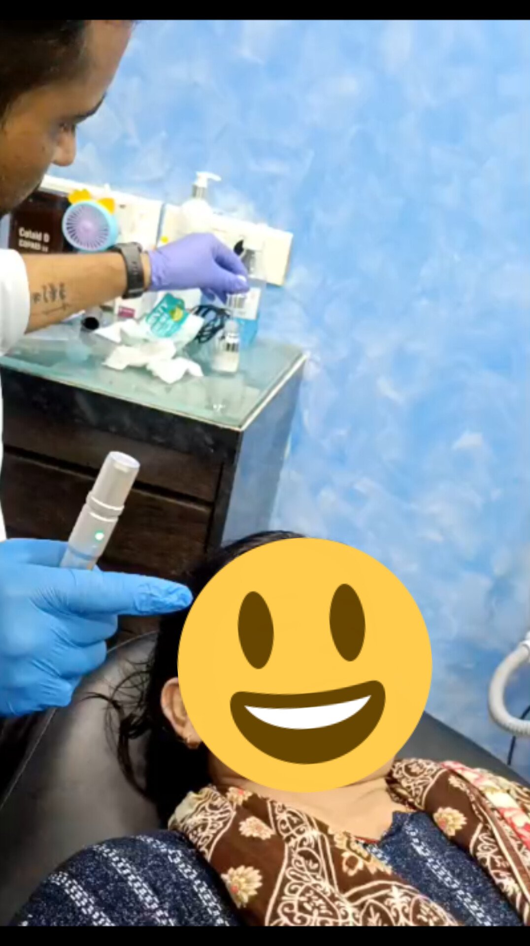 Micro needling/Subcison/ Acne scar treatment sub image