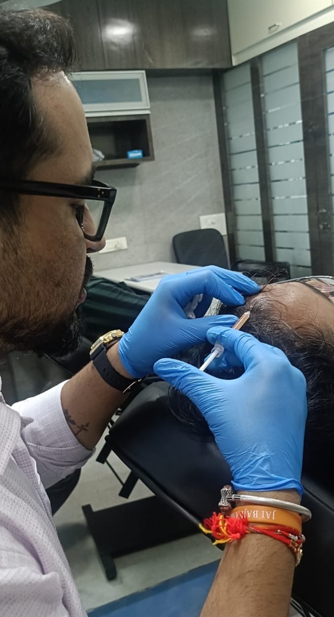 Advanced PRP / GFC Hair Restoration